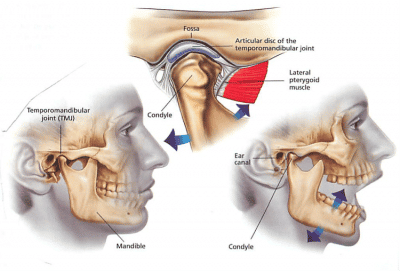 What’s TMJ Disorder