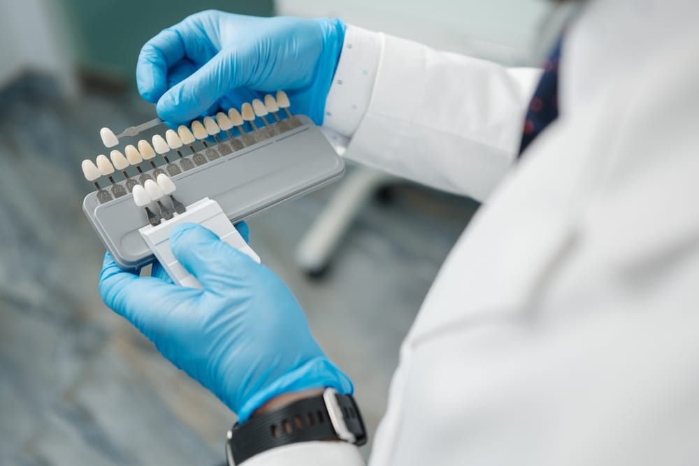 Dentist selecting tooth shade from porcelain veneer sample guide - Porcelain Veneers Close-up of a dentist wearing blue gloves and a white coat, holding a shade guide to match tooth color for porcelain veneers - Porcelain Veneers