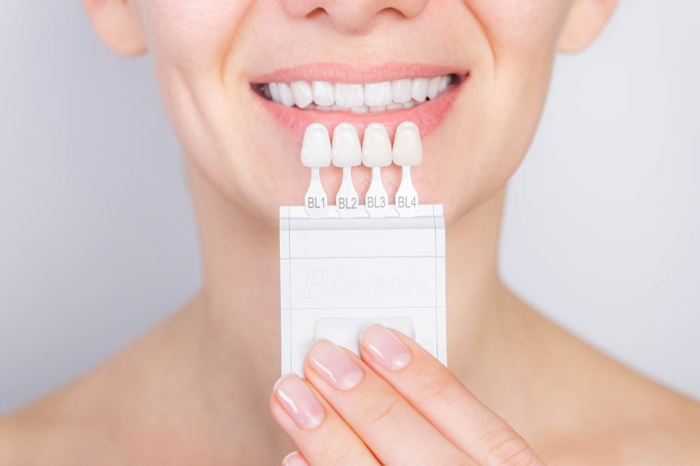 Smile Shade Matching with Veneers – Porcelain Veneers Close-up of a smiling woman holding a dental shade guide with veneer samples to match teeth color – Porcelain Veneers